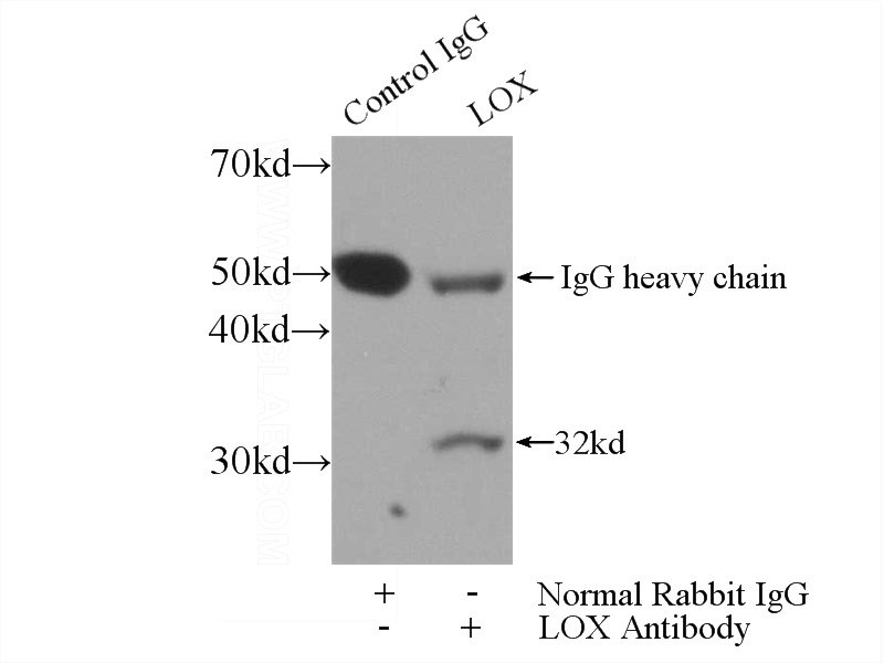 IP Result of anti-LOX (IP:Catalog No:112298, 3ug; Detection:Catalog No:112298 1:500) with mouse skeletal muscle tissue lysate 2000ug.