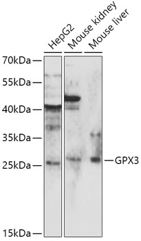 Western blot - GPX3 Polyclonal Antibody 