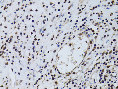 Immunohistochemistry - SIRT7 Polyclonal Antibody 