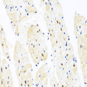 Immunohistochemistry - TAF9 Polyclonal Antibody 