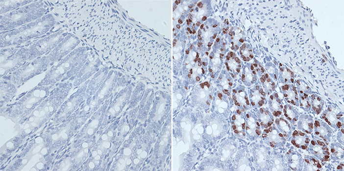 Immunohistochemistry - BrdU Monoclonal Antibody 
