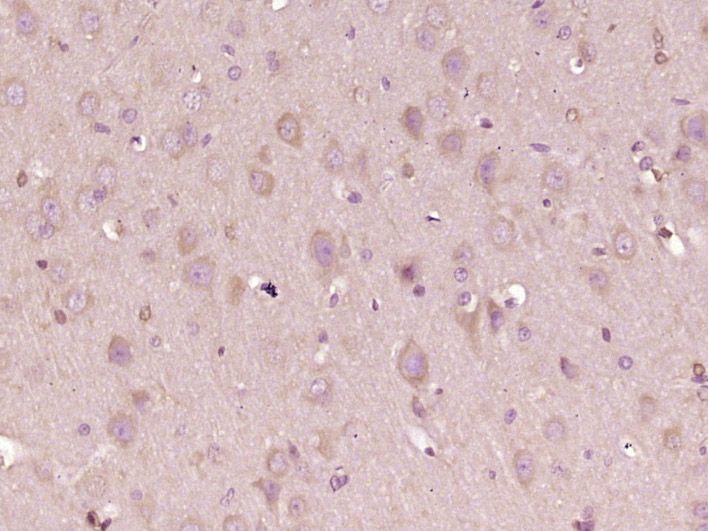 Fig1: Paraformaldehyde-fixed, paraffin embedded (rat brain tissue); Antigen retrieval by boiling in sodium citrate buffer (pH6.0) for 15min; Block endogenous peroxidase by 3% hydrogen peroxide for 20 minutes; Blocking buffer (normal goat serum) at 37℃ for 30min; Antibody incubation with (PDZD8 Polyclonal Antibody, Unconjugated at 1:400 overnight at 4℃, followed by operating according to SP Kit(Rabbit) (sp-0023) instructionsand DAB staining.