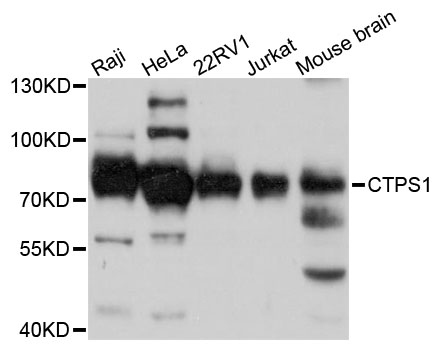 Western blot - CTPS1 Polyclonal Antibody 