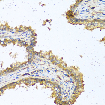 Immunohistochemistry - RNASE11 Polyclonal Antibody 