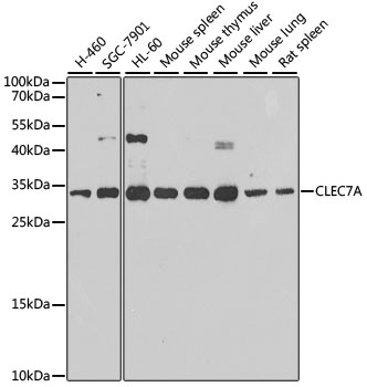 Western blot - CLEC7A Polyclonal Antibody 