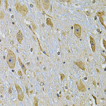 Immunohistochemistry - ITGA2 Polyclonal Antibody 