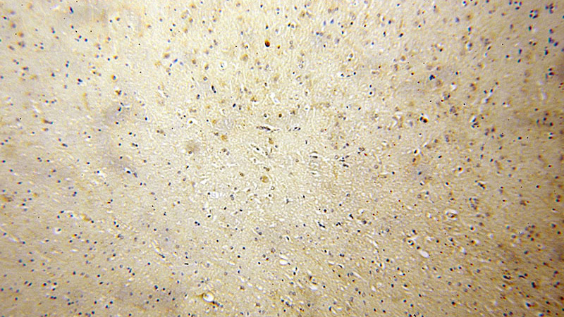 Immunohistochemical of paraffin-embedded human brain using Catalog No:114878(RPL23 antibody) at dilution of 1:50 (under 10x lens)
