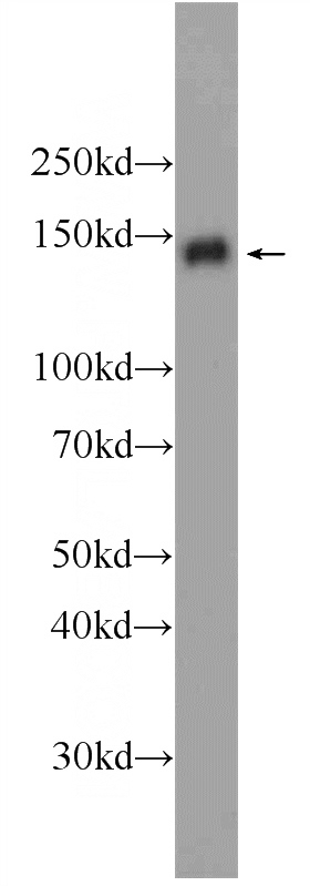 HeLa cells were subjected to SDS PAGE followed by western blot with Catalog No:113808(PHF14 Antibody) at dilution of 1:1000