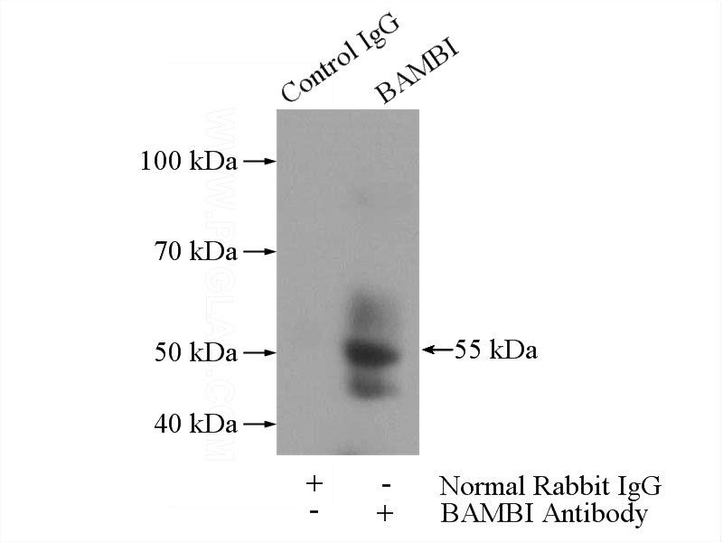 IP Result of anti-BAMBI (IP:Catalog No:108416, 3ug; Detection:Catalog No:108416 1:300) with mouse spleen tissue lysate 4000ug.