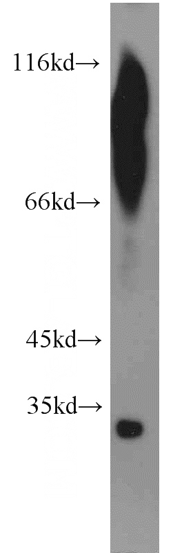 human testis tissue were subjected to SDS PAGE followed by western blot with Catalog No:112512(MEST antibody) at dilution of 1:500