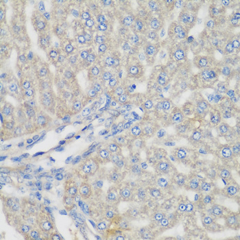 Immunohistochemistry - METTL7A Polyclonal Antibody 