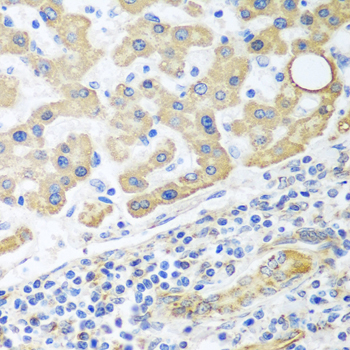 Immunohistochemistry - GLUD1 Polyclonal Antibody 
