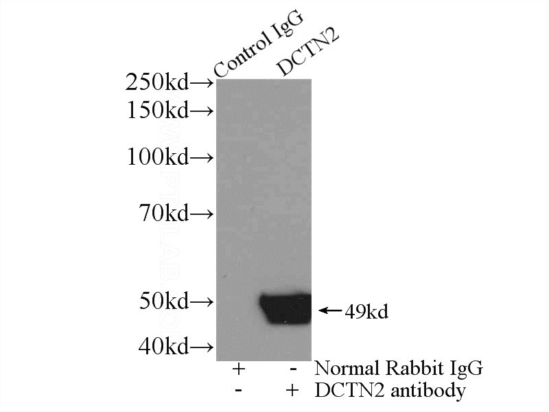 IP Result of anti-dynactin-2 (IP:Catalog No:110132, 3ug; Detection:Catalog No:110132 1:800) with mouse brain tissue lysate 4000ug.