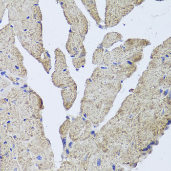 Immunohistochemistry - HBA2 Polyclonal Antibody 