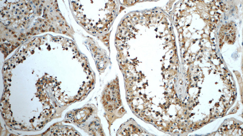 Immunohistochemistry of paraffin-embedded human testis tissue slide using Catalog No:109588(CRY1 Antibody) at dilution of 1:50 (under 10x lens)