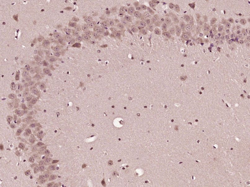 Fig3: Paraformaldehyde-fixed, paraffin embedded (Mouse brain); Antigen retrieval by boiling in sodium citrate buffer (pH6.0) for 15min; Block endogenous peroxidase by 3% hydrogen peroxide for 20 minutes; Blocking buffer (normal goat serum) at 37℃ for 30min; Antibody incubation with (CHAC1) Polyclonal Antibody, Unconjugated at 1:400 overnight at 4℃, followed by operating according to SP Kit(Rabbit) (sp-0023) instructionsand DAB staining.