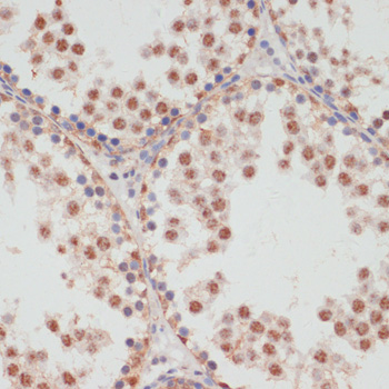 Immunohistochemistry - Phospho-PEA15-S104 pAb 