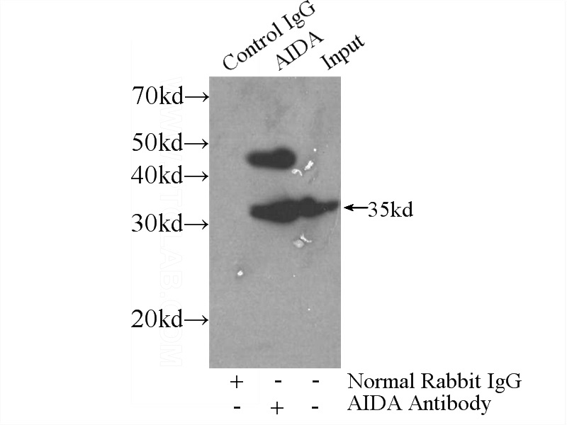 IP Result of anti-AIDA (IP:Catalog No:107850, 3ug; Detection:Catalog No:107850 1:600) with HeLa cells lysate 4000ug.