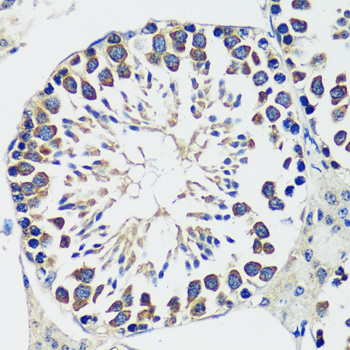 Immunohistochemistry - CCDC124 Polyclonal Antibody 