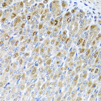 Immunohistochemistry - MTX2 Polyclonal Antibody 