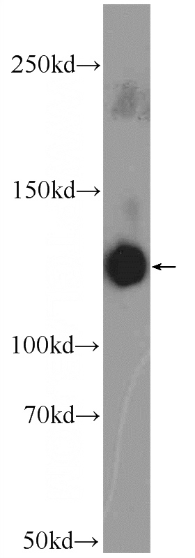 rat brain tissue were subjected to SDS PAGE followed by western blot with Catalog No:109362(CNTN1 Antibody) at dilution of 1:1200