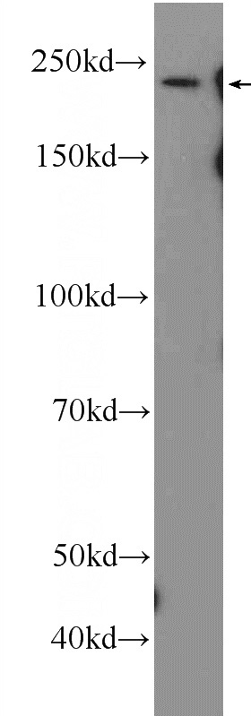 mouse heart tissue were subjected to SDS PAGE followed by western blot with Catalog No:112936(MYH7 Antibody) at dilution of 1:2000
