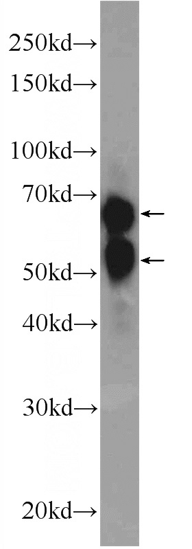 U-937 cells were subjected to SDS PAGE followed by western blot with Catalog No:110894(GBP5 Antibody) at dilution of 1:1500