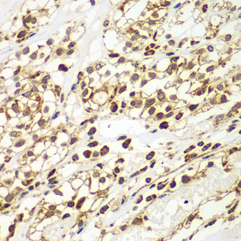 Immunohistochemistry - SMAD9 Polyclonal Antibody 