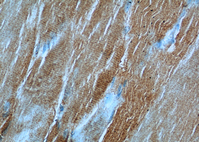 Immunohistochemistry of paraffin-embedded human skeletal muscle tissue slide using Catalog No:113820(PHKB Antibody) at dilution of 1:50 (under 40x lens)