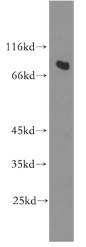 A549 cells were subjected to SDS PAGE followed by western blot with Catalog No:114724(RMP antibody) at dilution of 1:500