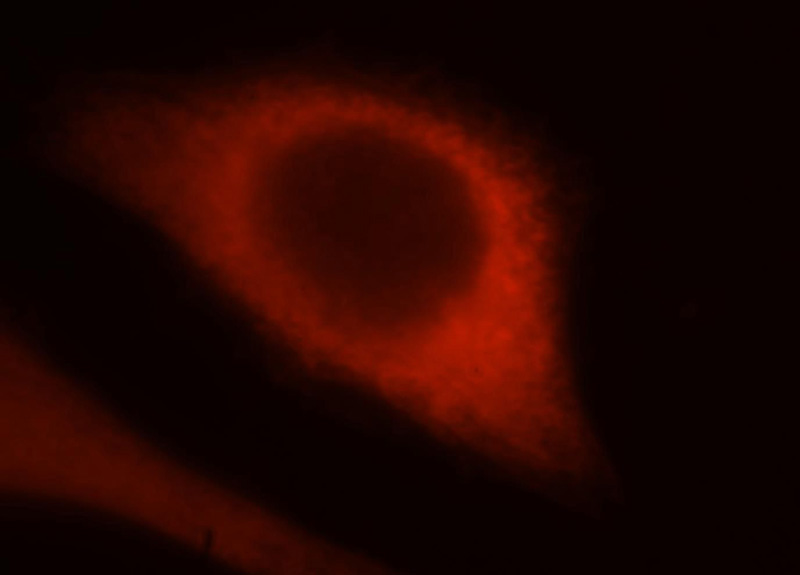 Immunofluorescent analysis of Hela cells, using ALDOA antibody Catalog No:107976 at 1:25 dilution and Rhodamine-labeled goat anti-rabbit IgG (red).