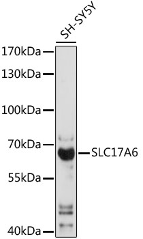 Western blot - SLC17A6 Polyclonal Antibody 