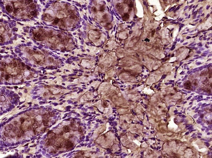 Fig1: Paraformaldehyde-fixed, paraffin embedded (mouse colon tissue); Antigen retrieval by boiling in sodium citrate buffer (pH6.0) for 15min; Block endogenous peroxidase by 3% hydrogen peroxide for 20 minutes; Blocking buffer (normal goat serum) at 37℃ for 30min; Antibody incubation with (IL-9) Polyclonal Antibody, Unconjugated at 1:400 overnight at 4℃, followed by operating according to SP Kit(Rabbit) (sp-0023) instructionsand DAB staining.