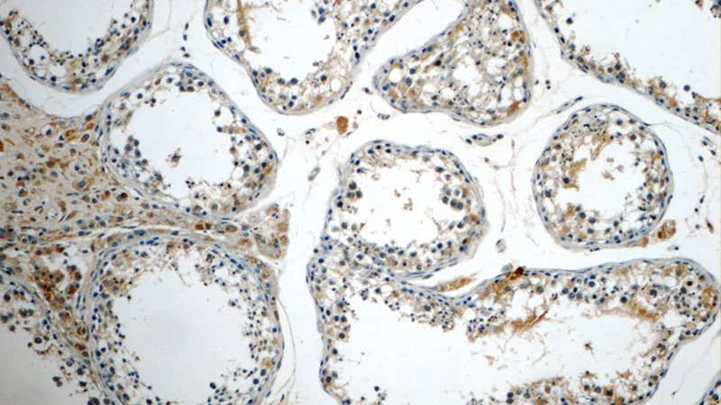 Immunohistochemistry of paraffin-embedded human testis tissue slide using Catalog No:112532(MFSD2 Antibody) at dilution of 1:50 (under 10x lens)