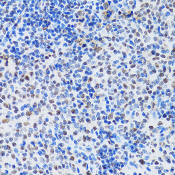 Immunohistochemistry - MTA3 Polyclonal Antibody 