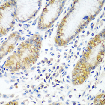 Immunohistochemistry - ATAD3A Polyclonal Antibody 