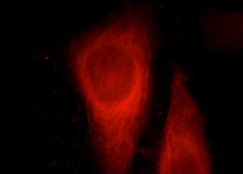 Immunofluorescent analysis of HepG2 cells, using SERPINB10 antibody Catalog No:115200 at 1:25 dilution and Rhodamine-labeled goat anti-rabbit IgG (red).