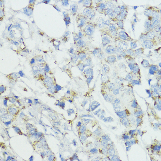 Immunohistochemistry - SOD3 Polyclonal Antibody 