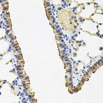 Immunohistochemistry - ACSS2 Polyclonal Antibody 