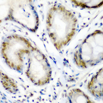 Immunohistochemistry - SS18 Polyclonal Antibody 