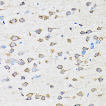 Immunohistochemistry - COPB2 Polyclonal Antibody 