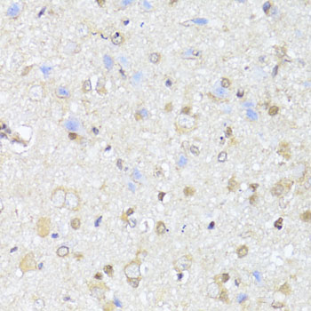 Immunohistochemistry - EGLN1/EGLN2 Polyclonal Antibody 