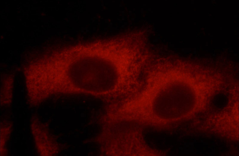 Immunofluorescent analysis of SH-SY5Y cells using Catalog No:107029(C9orf72 Antibody) at dilution of 1:25 and Rhodamine-Goat anti-Mouse IgG