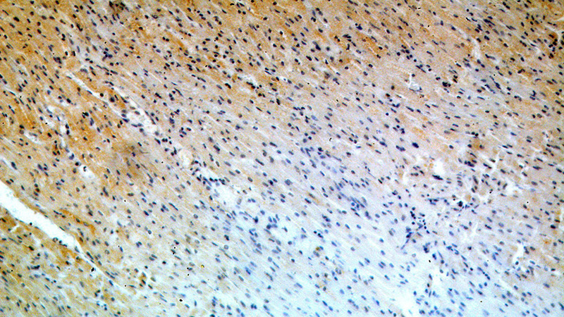 Immunohistochemical of paraffin-embedded human heart using Catalog No:113520(OVCA1 antibody) at dilution of 1:50 (under 10x lens)