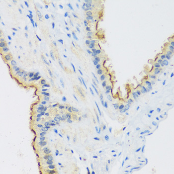 Immunohistochemistry - C1GALT1 Polyclonal Antibody 