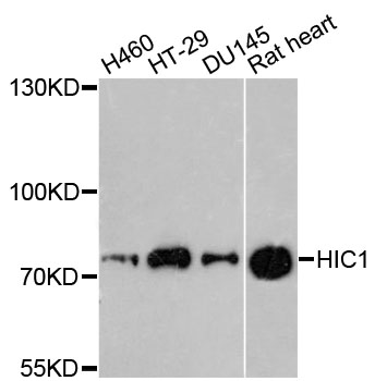 Western blot - HIC1 Polyclonal Antibody 