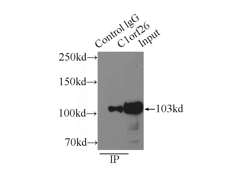 IP Result of anti-C1orf26 (IP:Catalog No:108675, 5ug; Detection:Catalog No:108675 1:500) with mouse testis tissue lysate 8000ug.