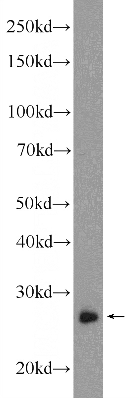 mouse lung tissue were subjected to SDS PAGE followed by western blot with Catalog No:114444(RAB3D Antibody) at dilution of 1:1200