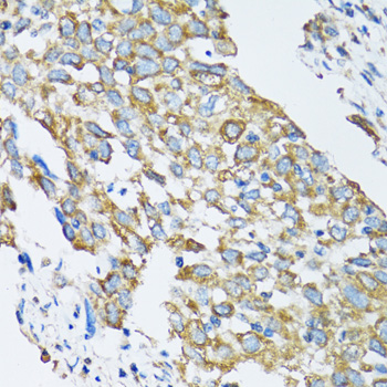 Immunohistochemistry - SLC25A13 Polyclonal Antibody 