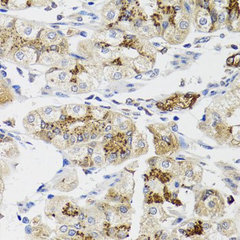 Immunohistochemistry - LFNG Polyclonal Antibody 